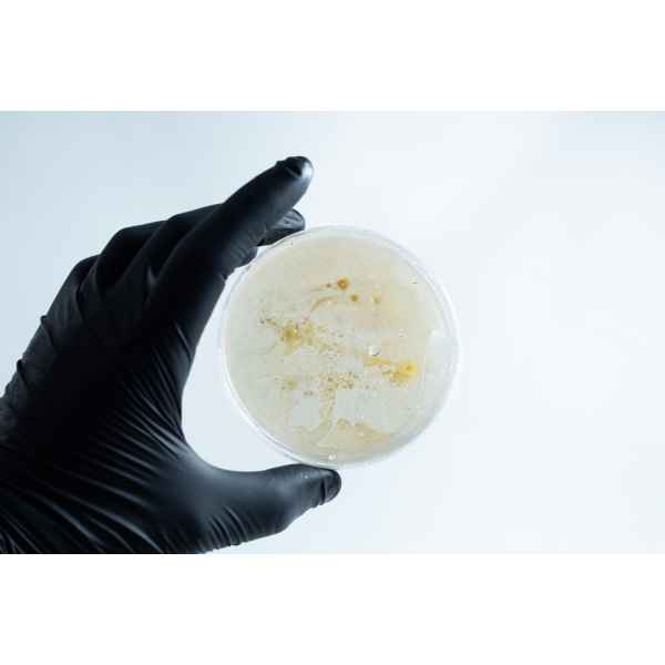 Agar petri dish MEA School Science Fun Project - Stage 1 Contamination.