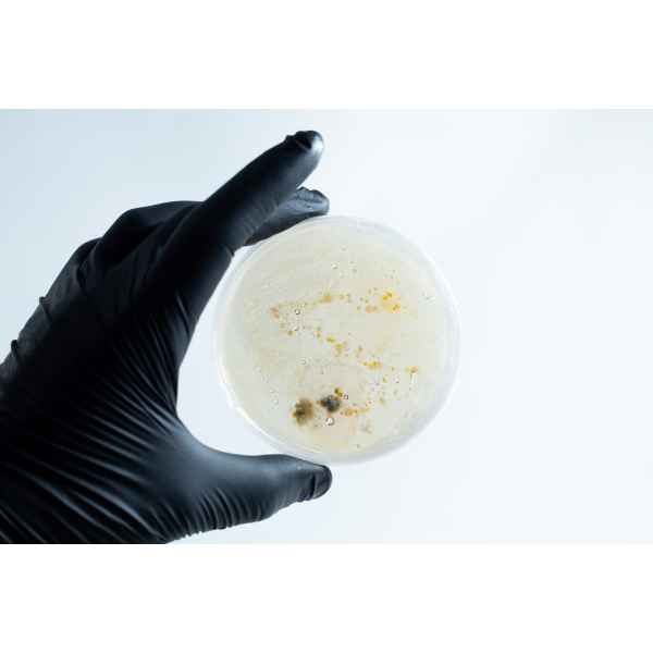 Agar petri dish MEA School Science Fun Project - Stage 2 Contamination